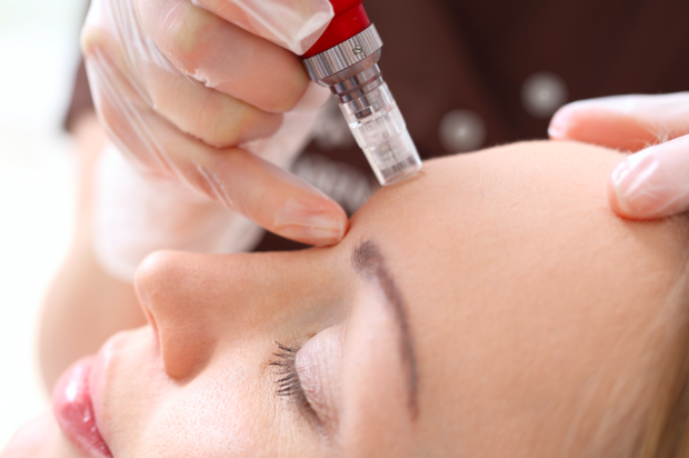 Skin Needling Face, Neck and Décolletage