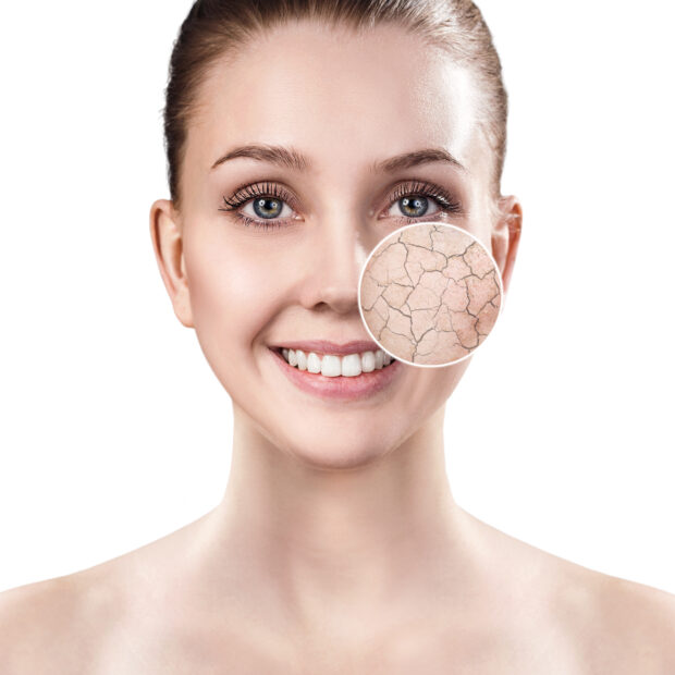 Coolifting Cryo Facial - Face, Neck and Décolletage