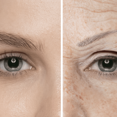 Non-Injectable Eye Rejuvenation Package